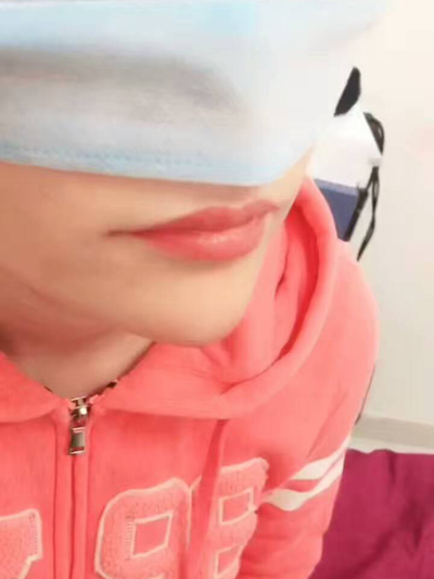 下巴填充