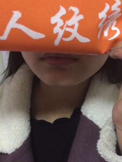 下巴填充