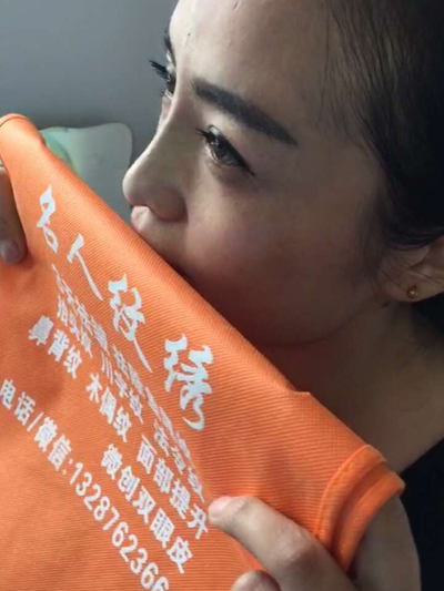 线雕隆鼻